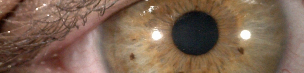 La Tecnica Iridologica. Come si guarda un occhio? Ovvero, come opera un iridologo.